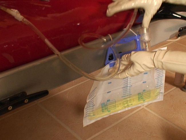 Doktorspiele mit dem Speku**m